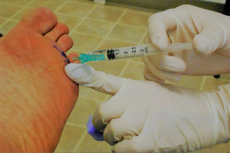 Warning Signs Of Diabetic Foot Problems